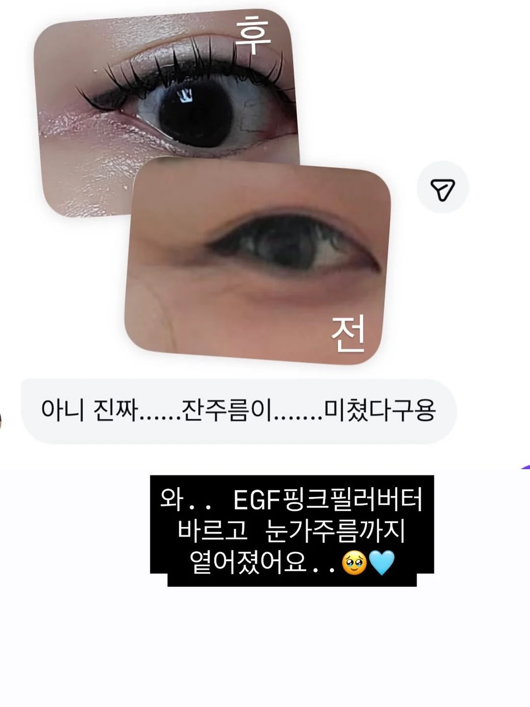 바디드라이어 16