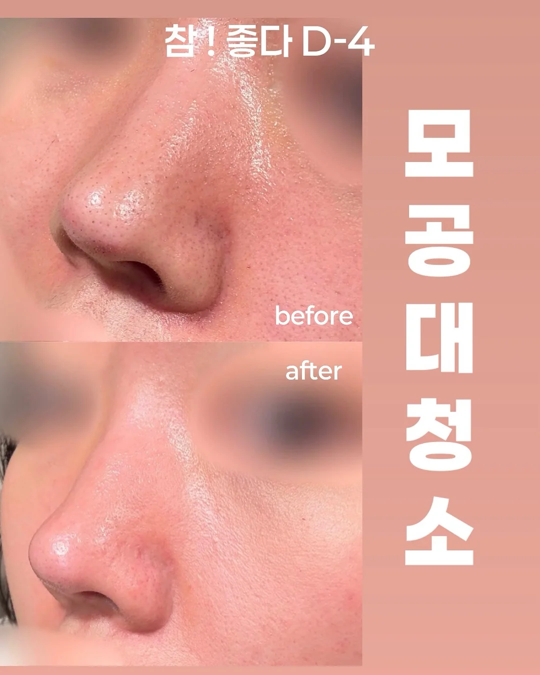 코코 코로쉐 니트셋업 1