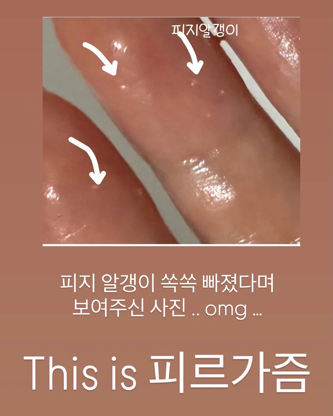코코 코로쉐 니트셋업 5