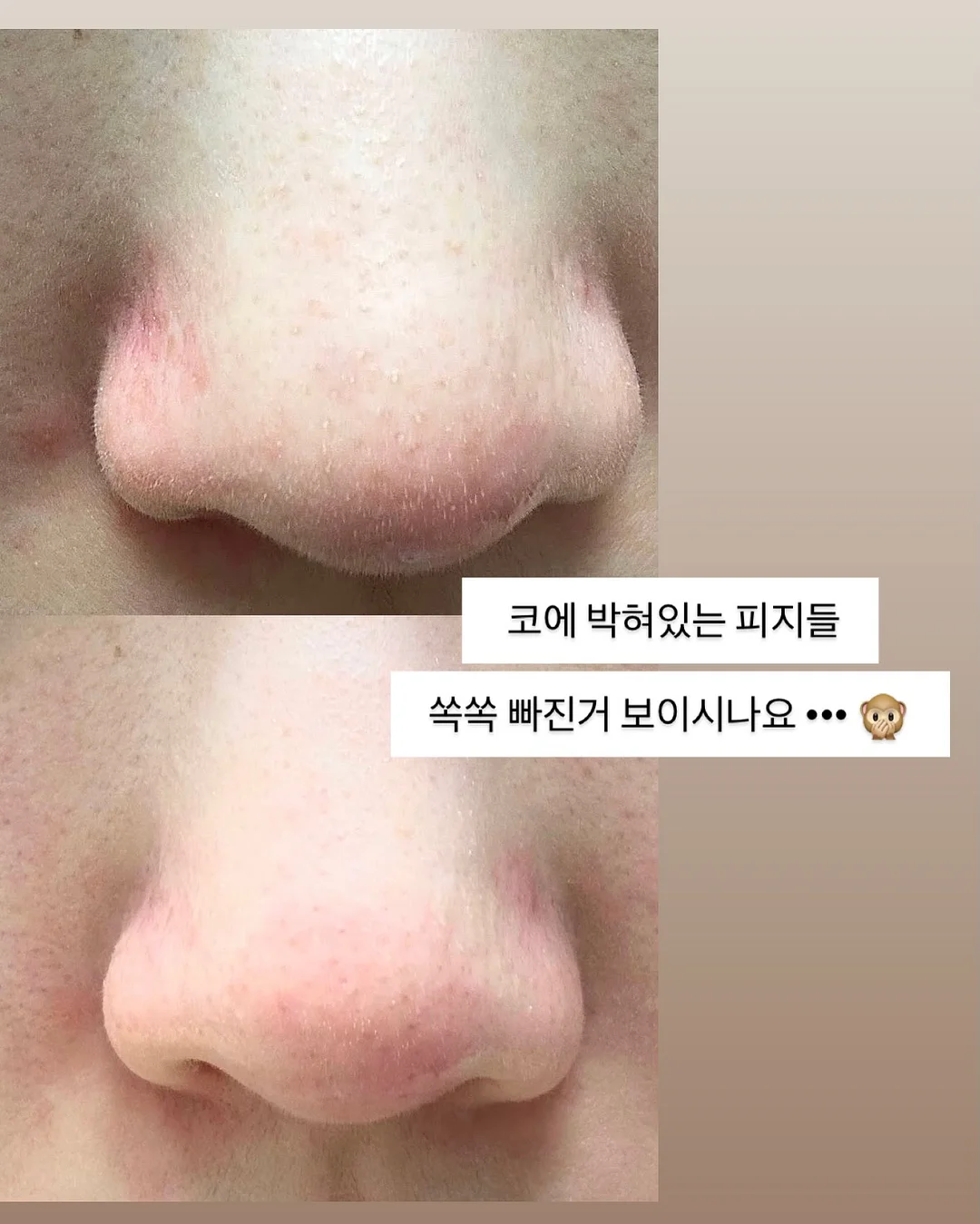 코코 코로쉐 니트셋업 8
