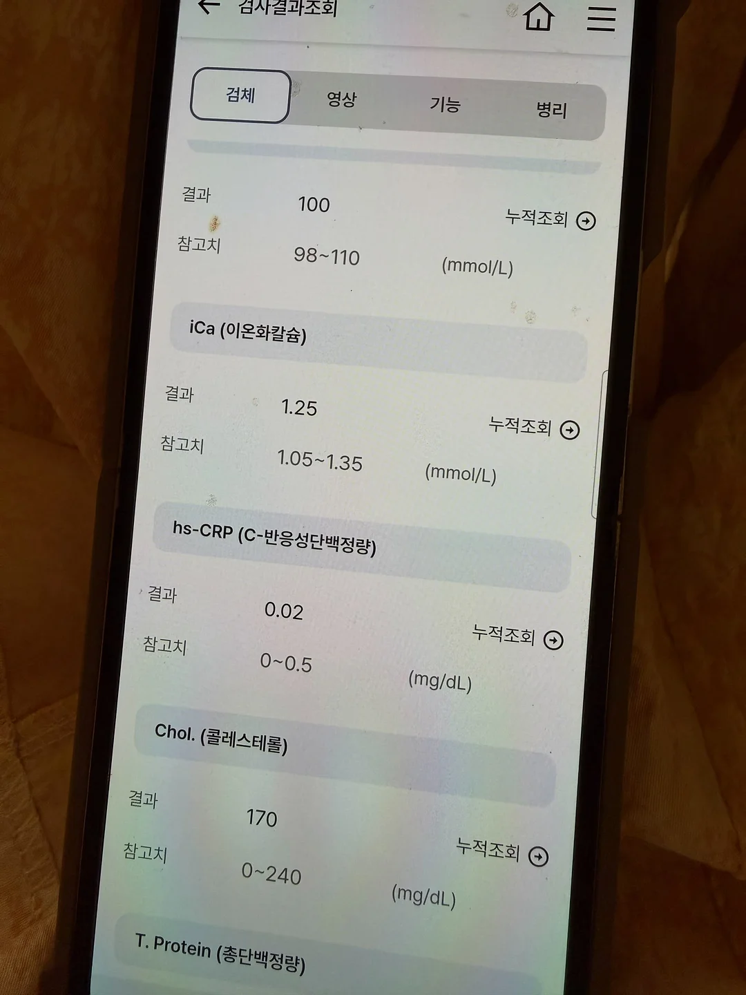 서울대 간 암기 방법 8