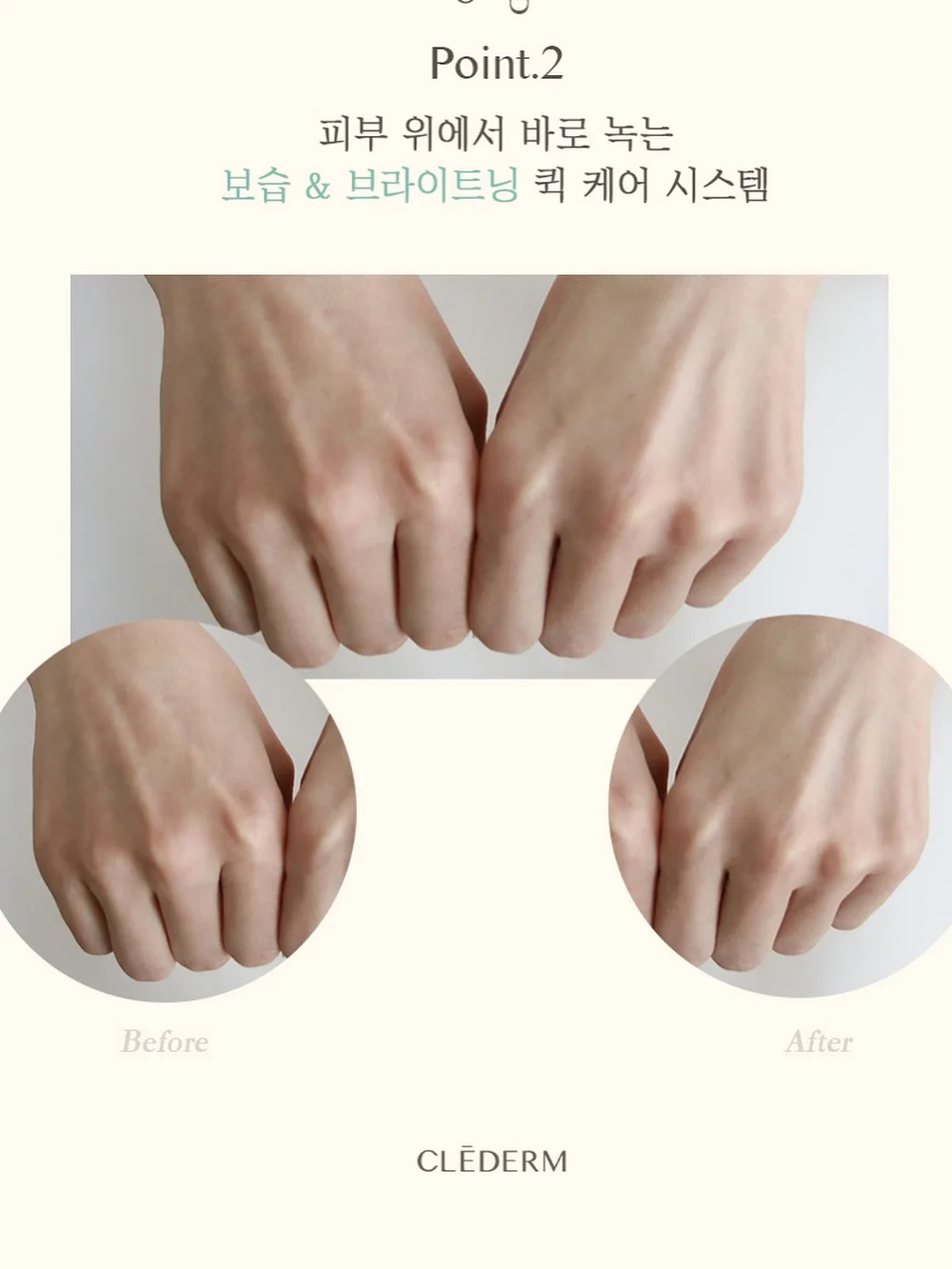 슈가드레싱 리쥬란성분 재생크림 8