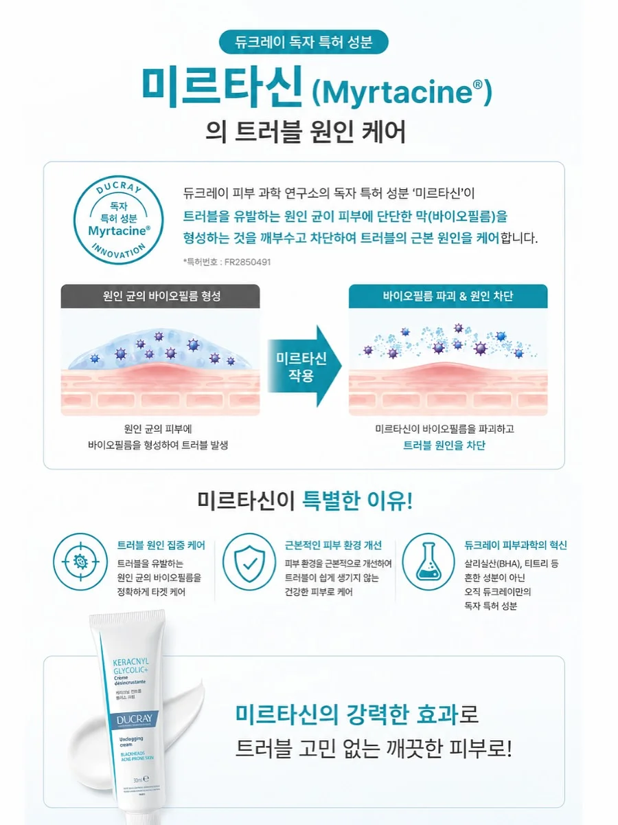 노버클 벨트 17
