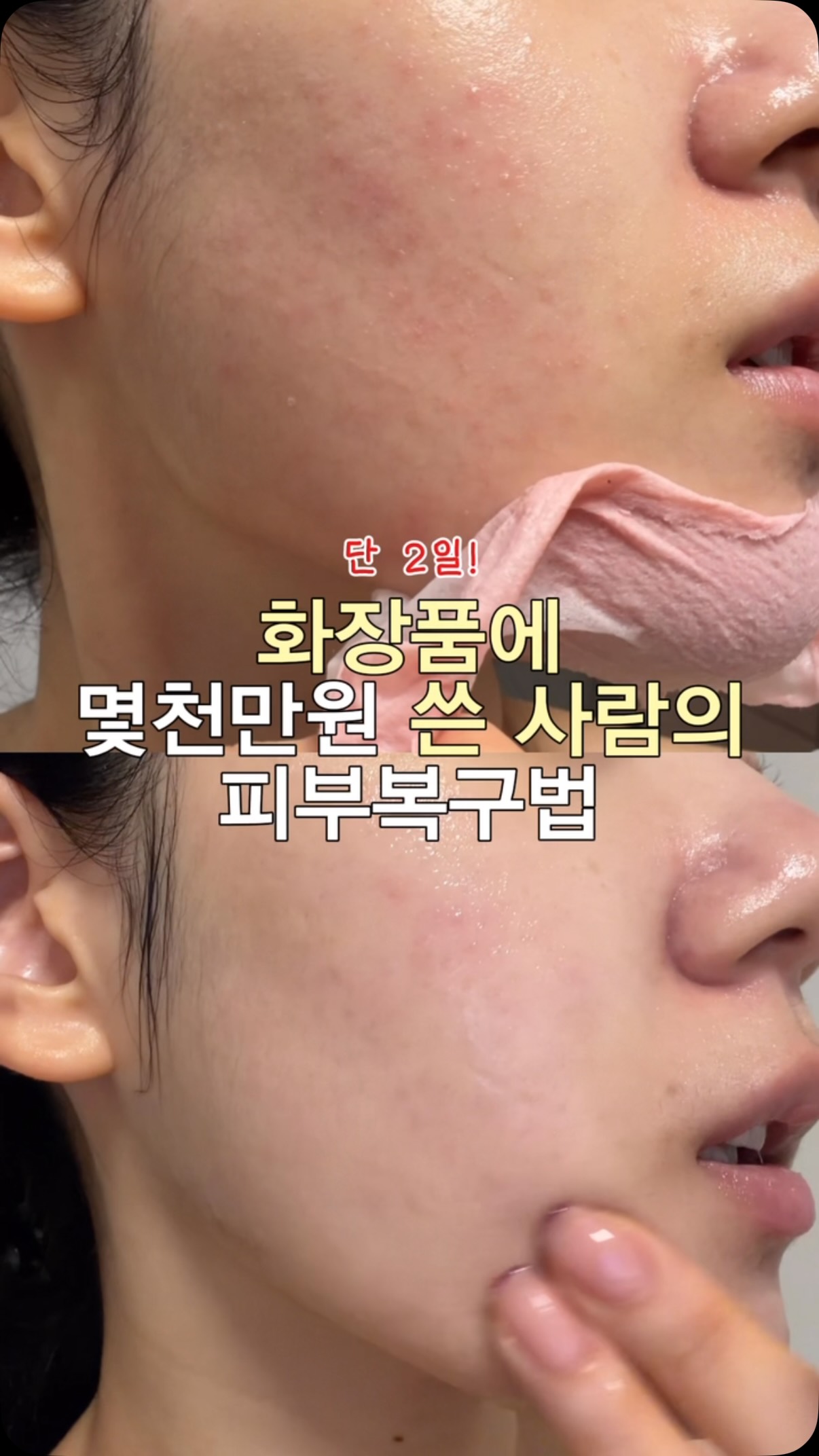아이스밴딩부츠컷