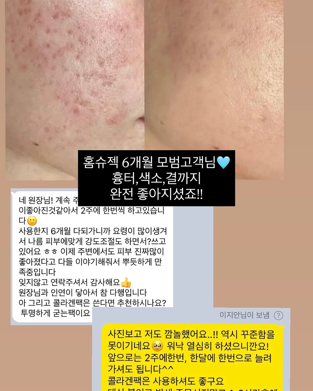 아테네 가디건 3