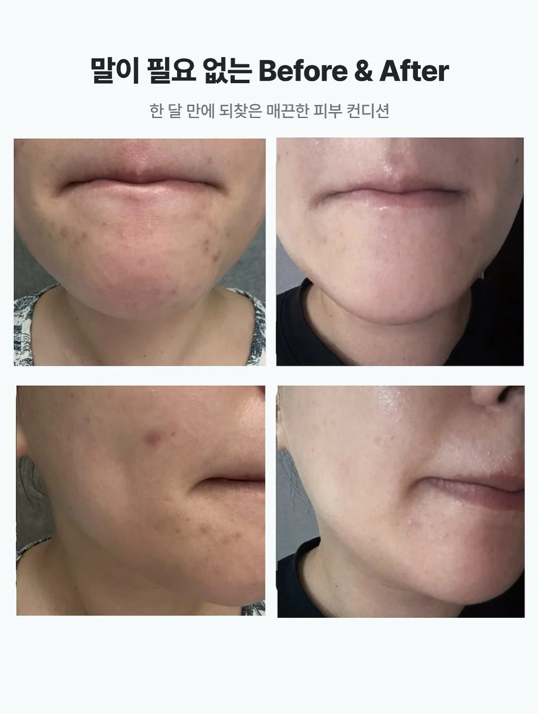 보냉백 2