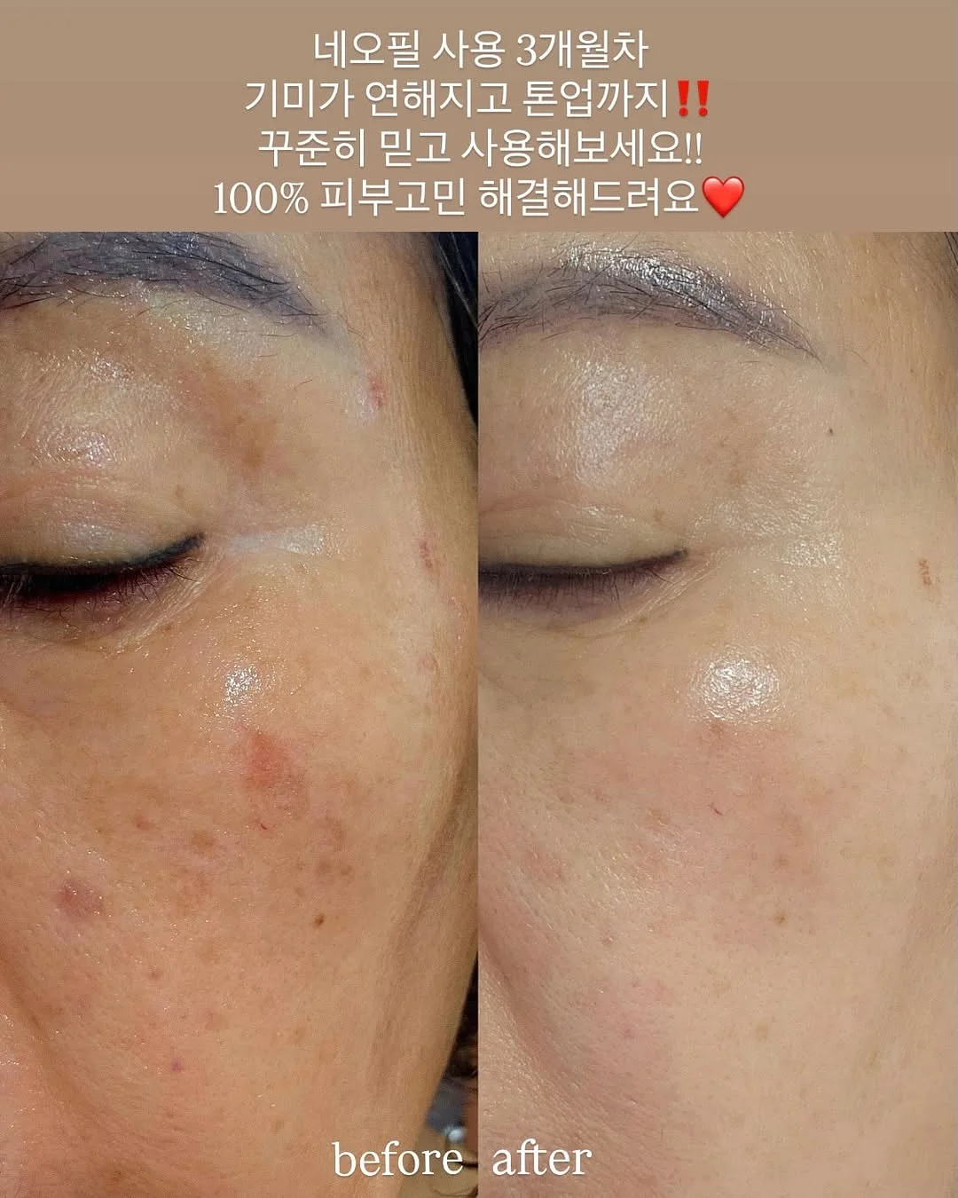 견과류 2