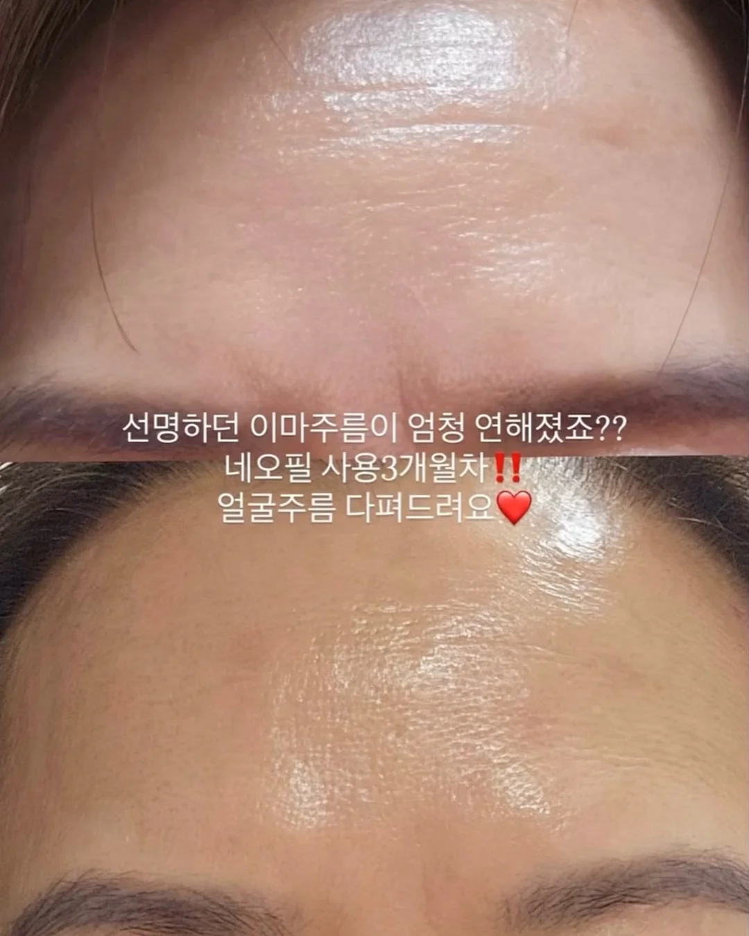 견과류 3