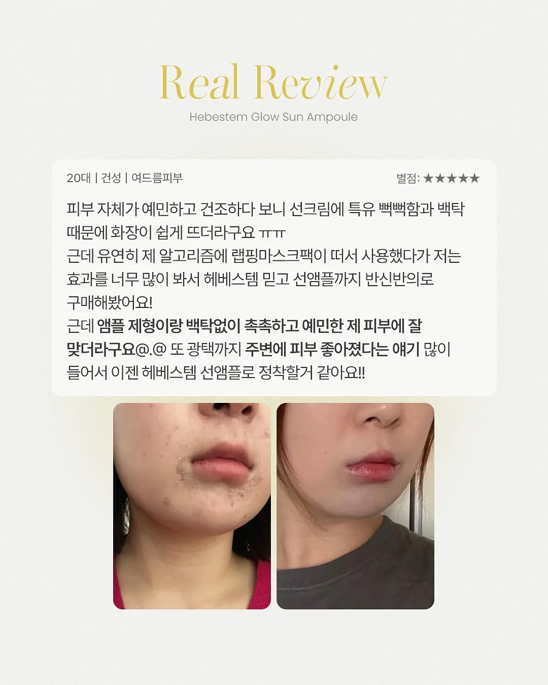 일제 티단추 6