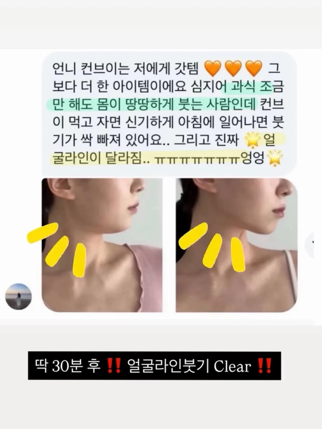 순환관리 기기 5
