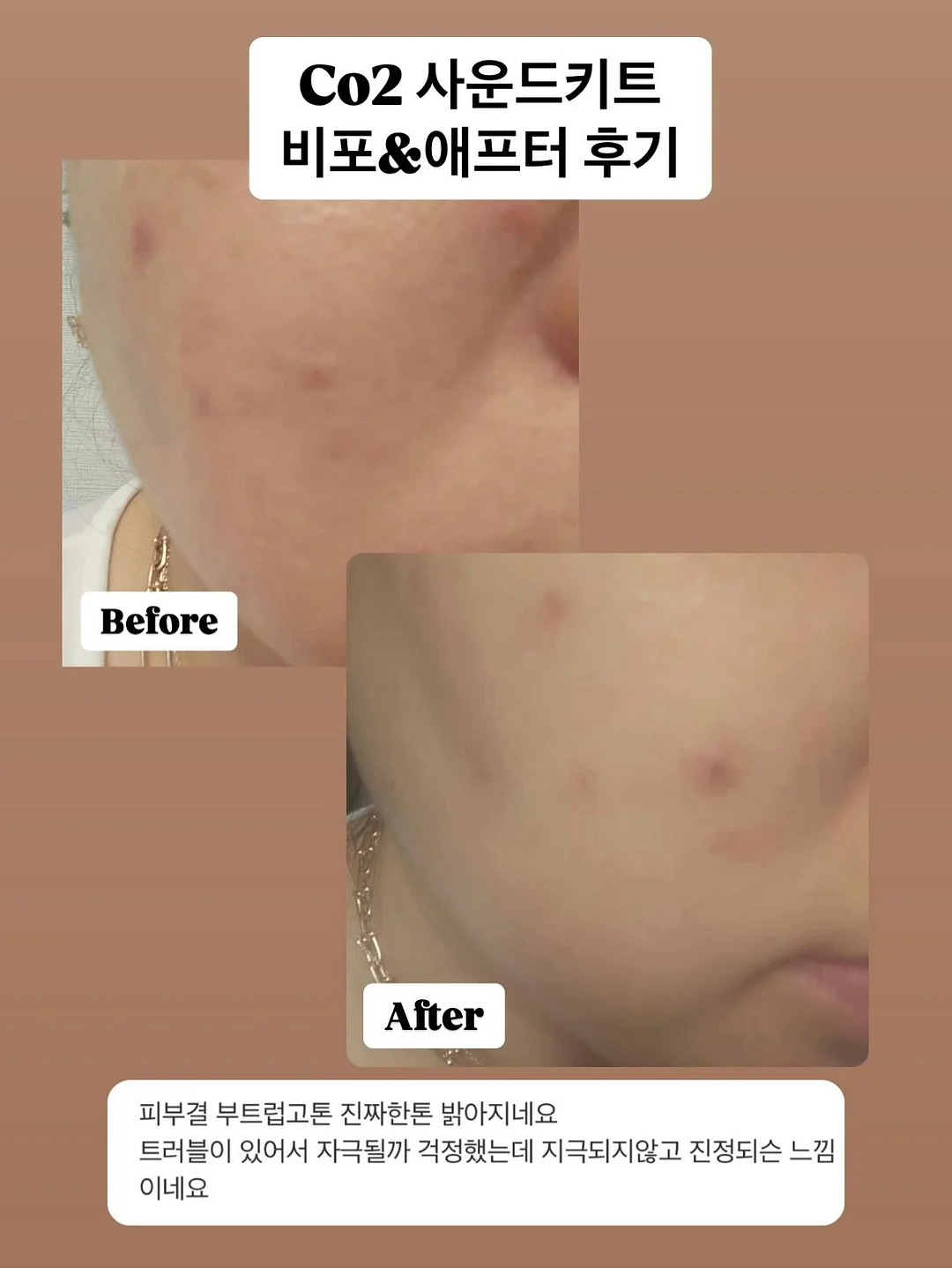 끌리젠 써큘레이터 16