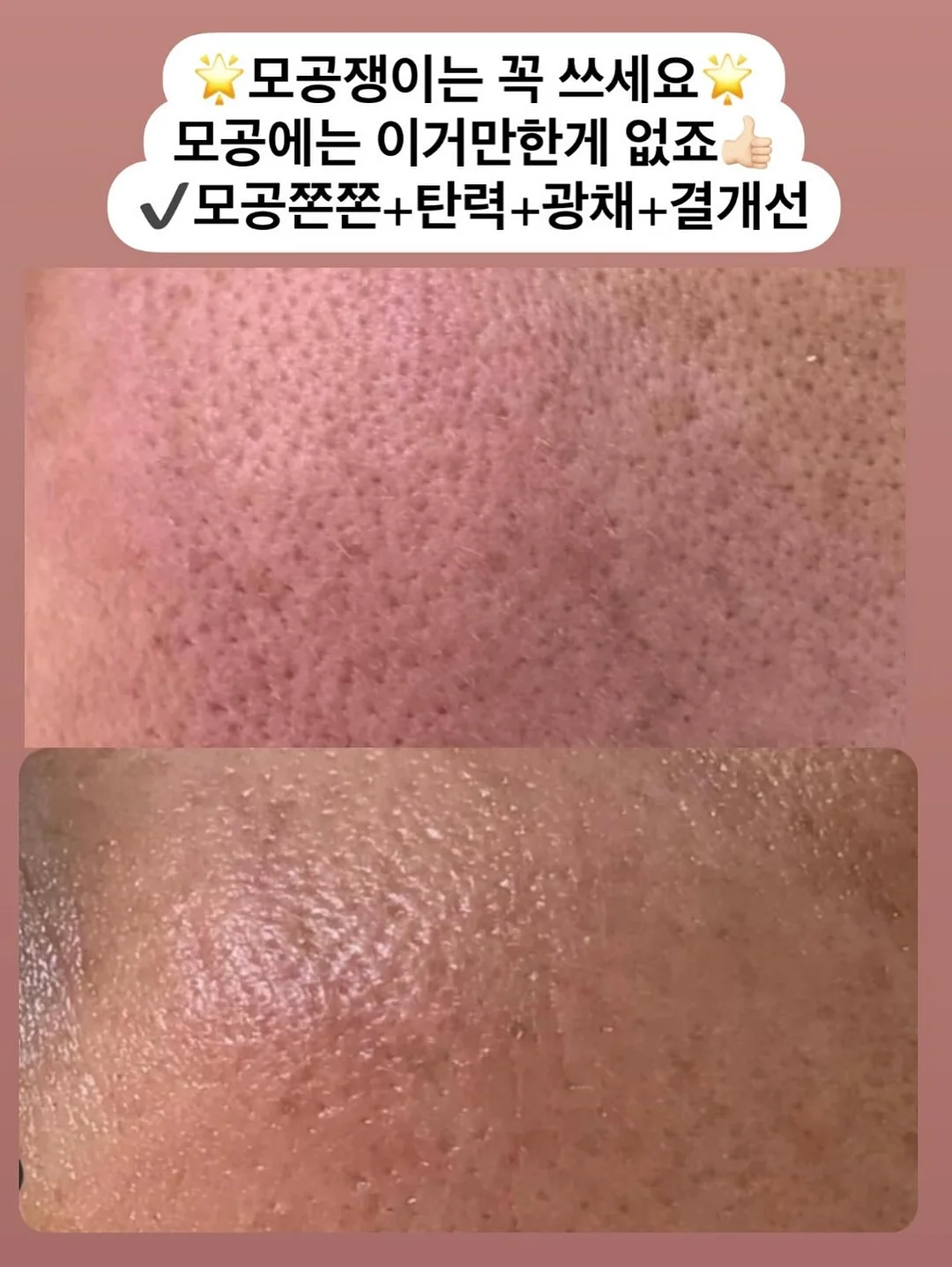 끌리젠 써큘레이터 6