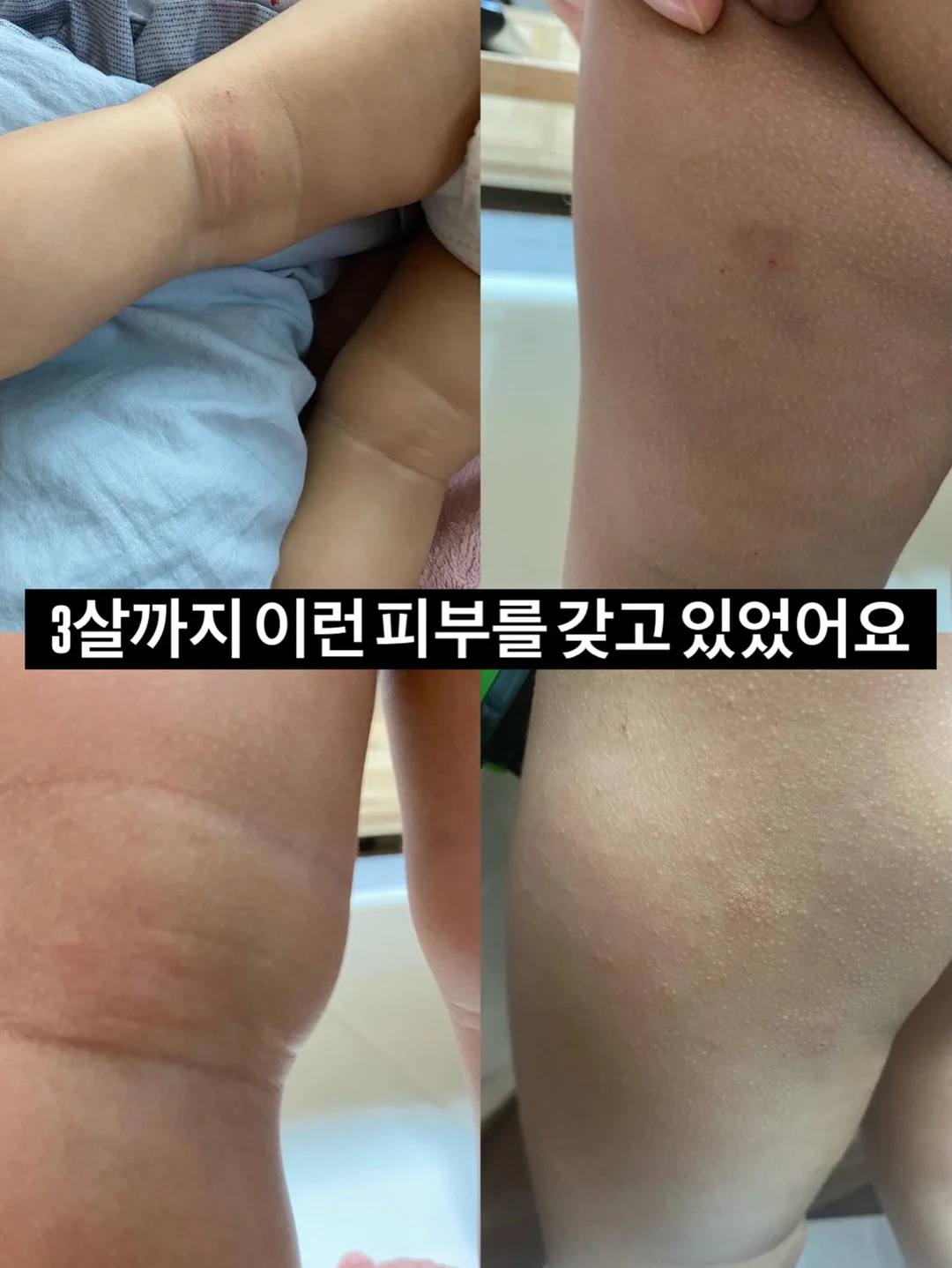 아몬드니트비니 3