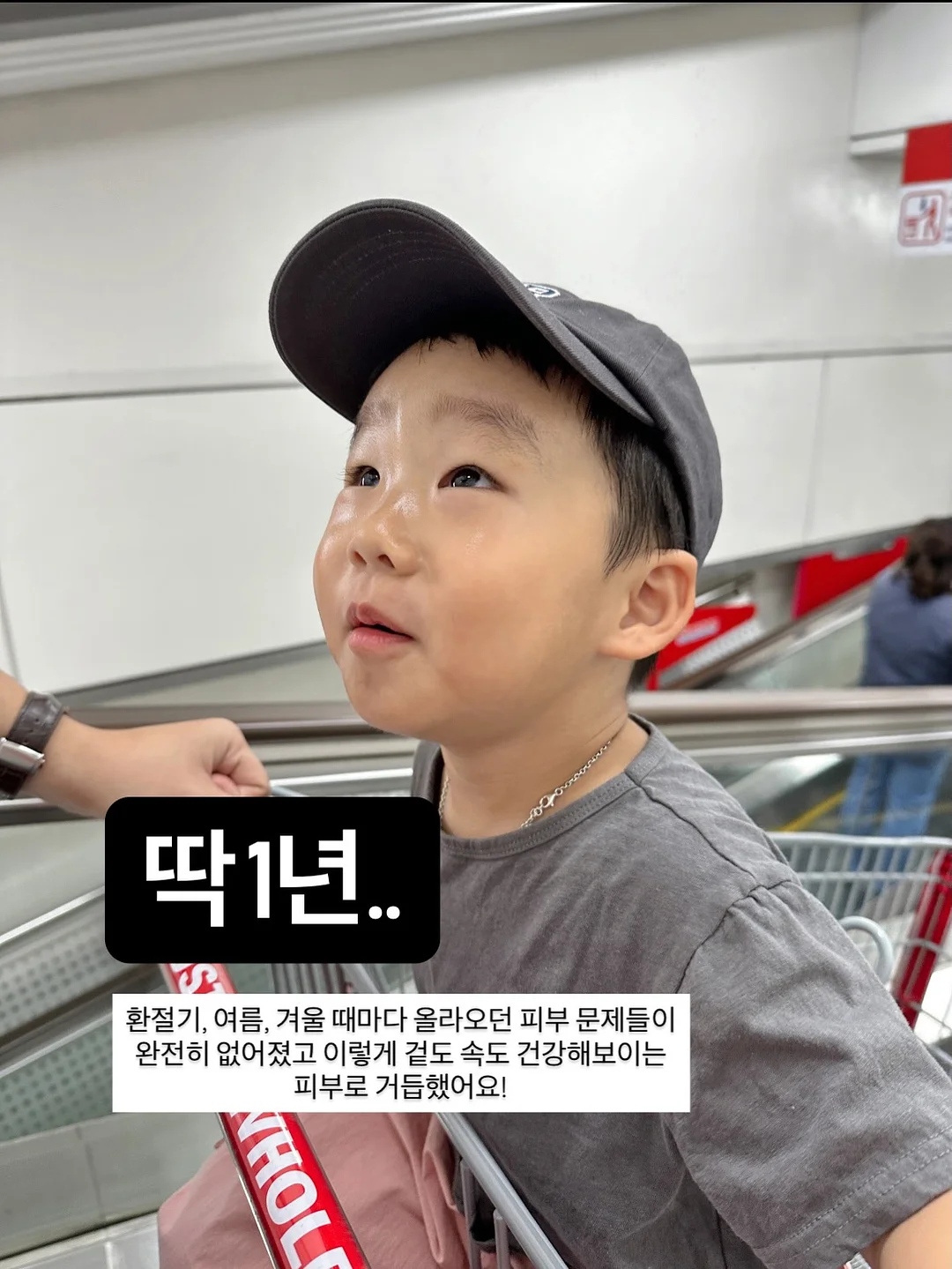 아몬드니트비니 5