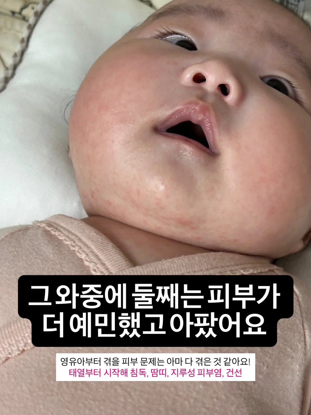 아몬드니트비니 7