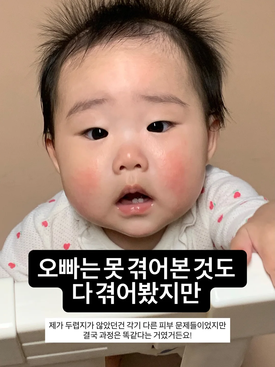 아몬드니트비니 8