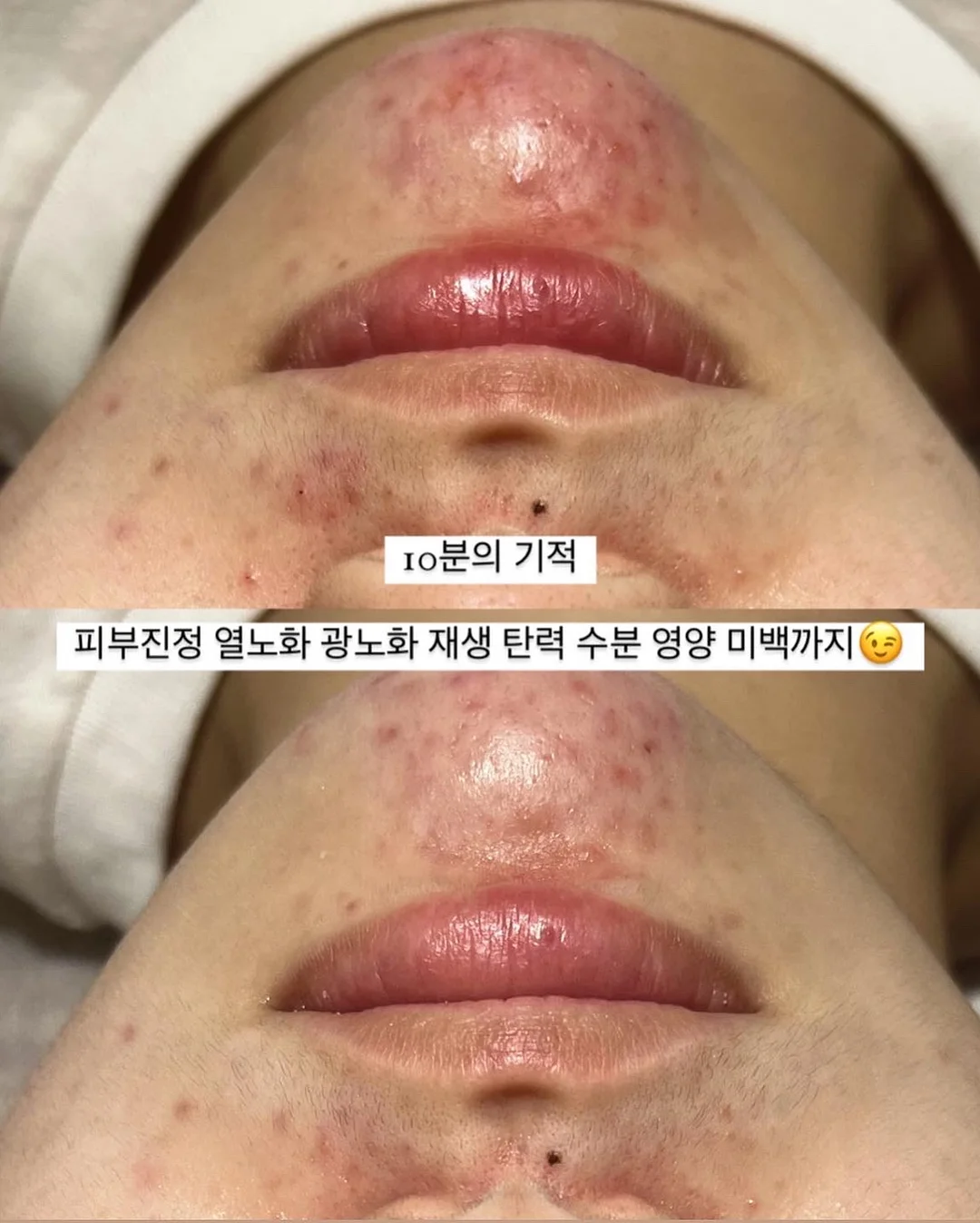 올유베베 컬러팜 상하복 3