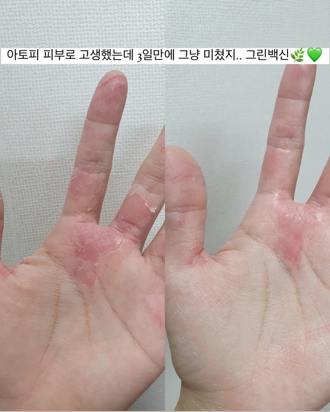 올유베베 컬러팜 상하복 4