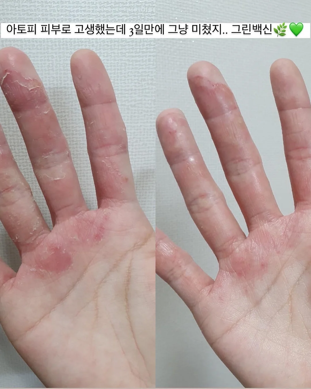 올유베베 컬러팜 상하복 5