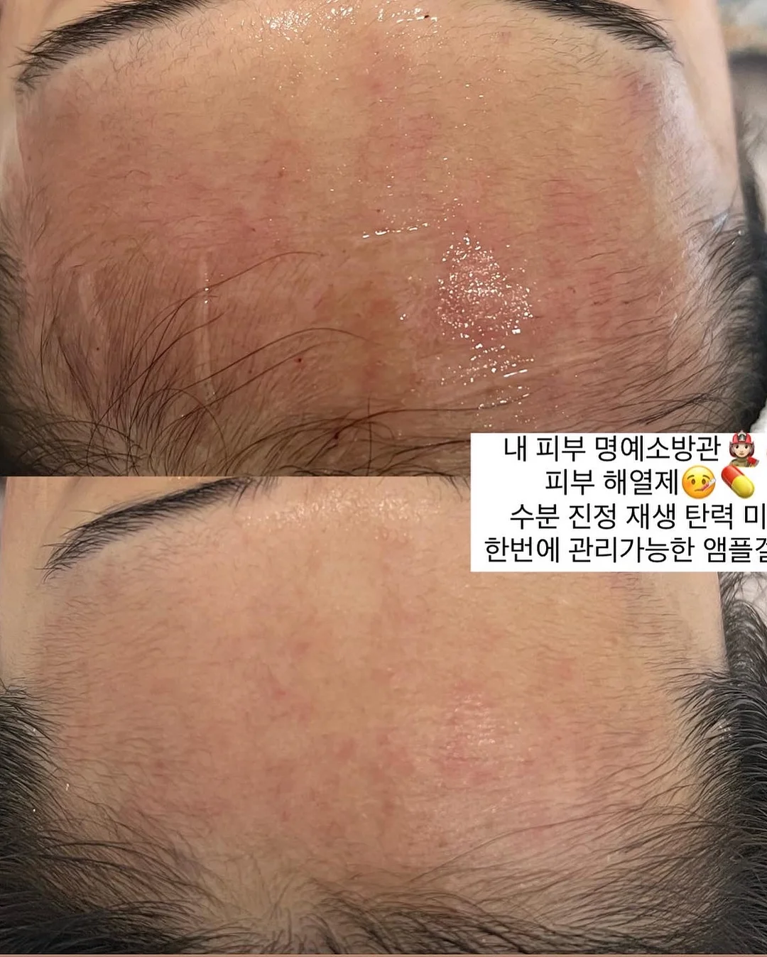 올유베베 컬러팜 상하복 6
