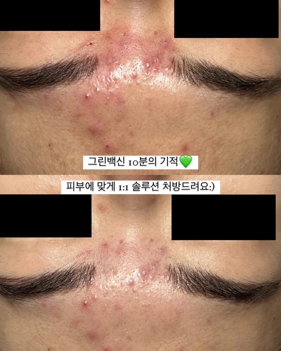 올유베베 컬러팜 상하복 7