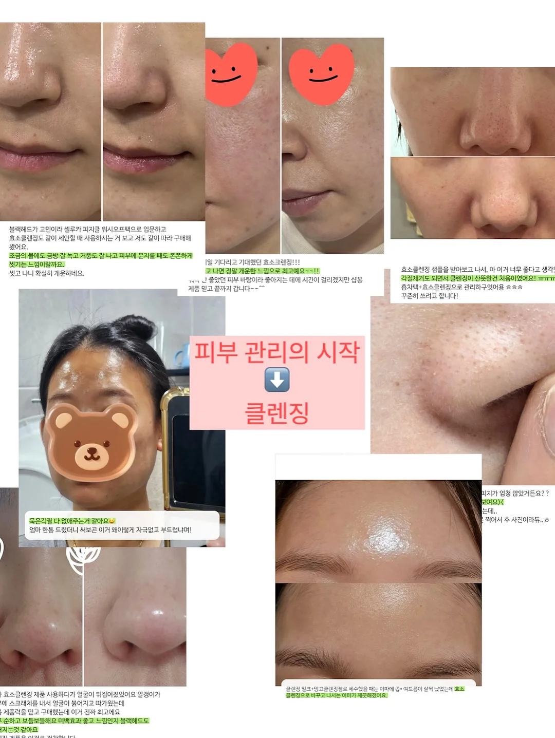 고무줄 12
