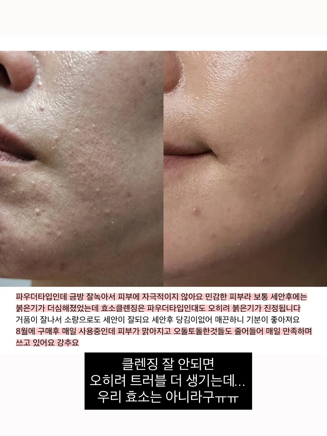 고무줄 9