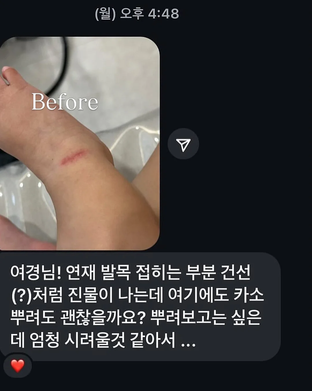 입간판 5