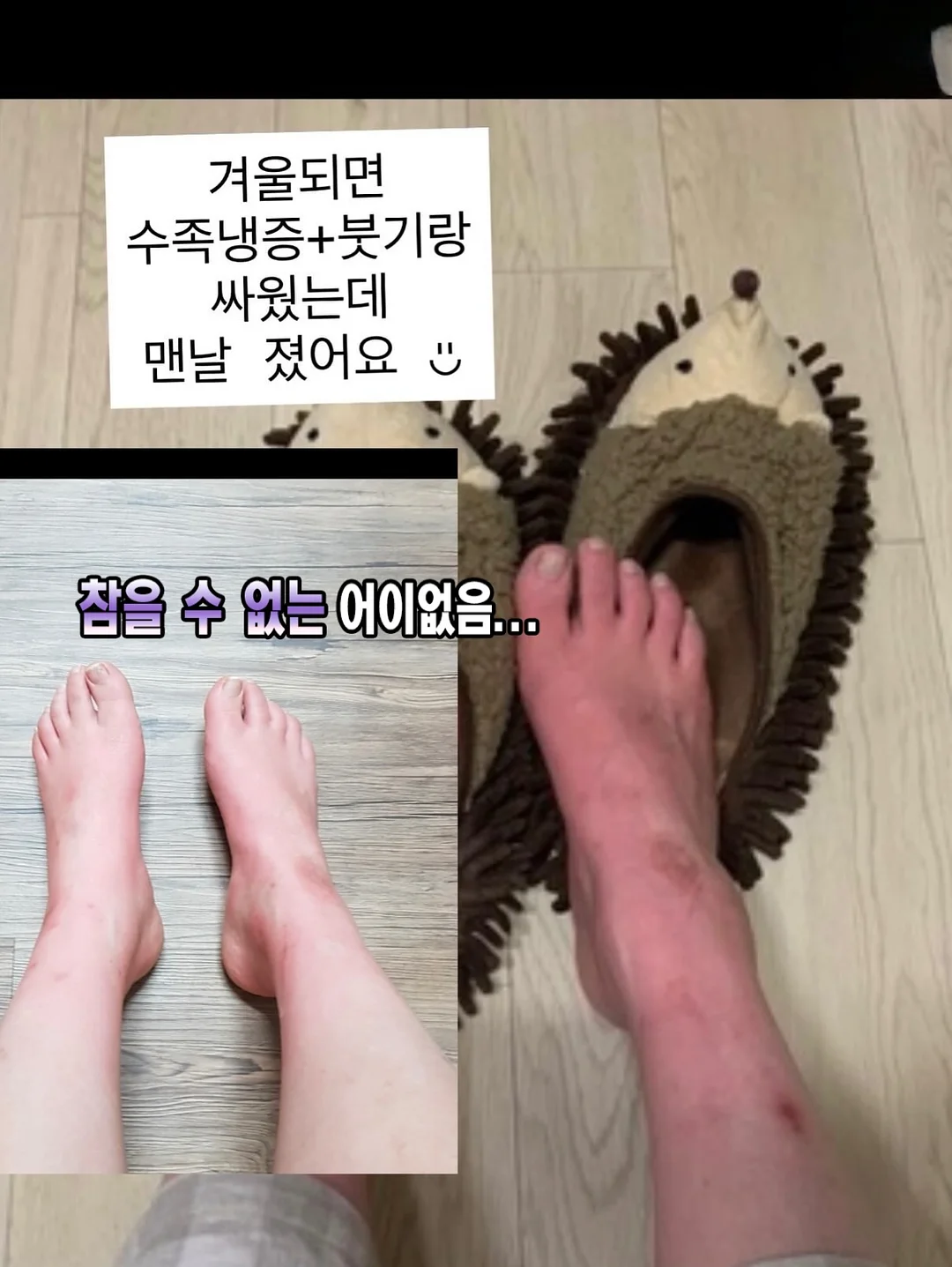 노글루 수분영양펌 5