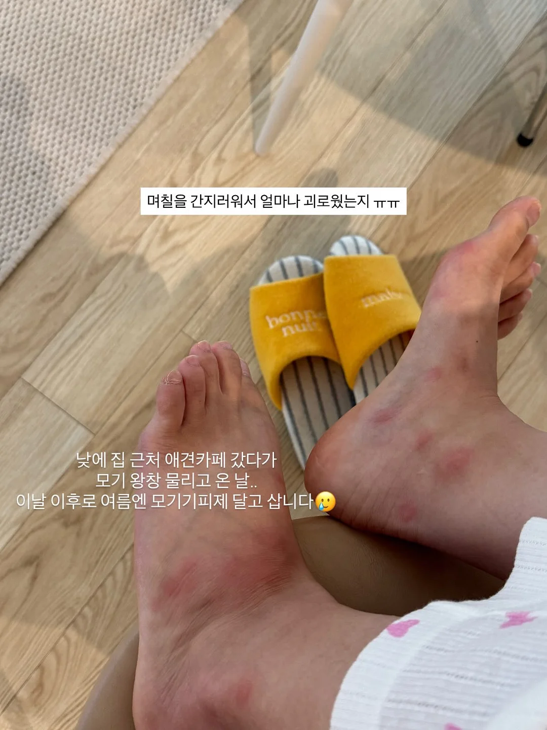 똑딱핀 9