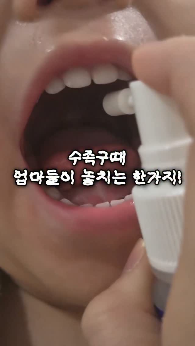 악세사리