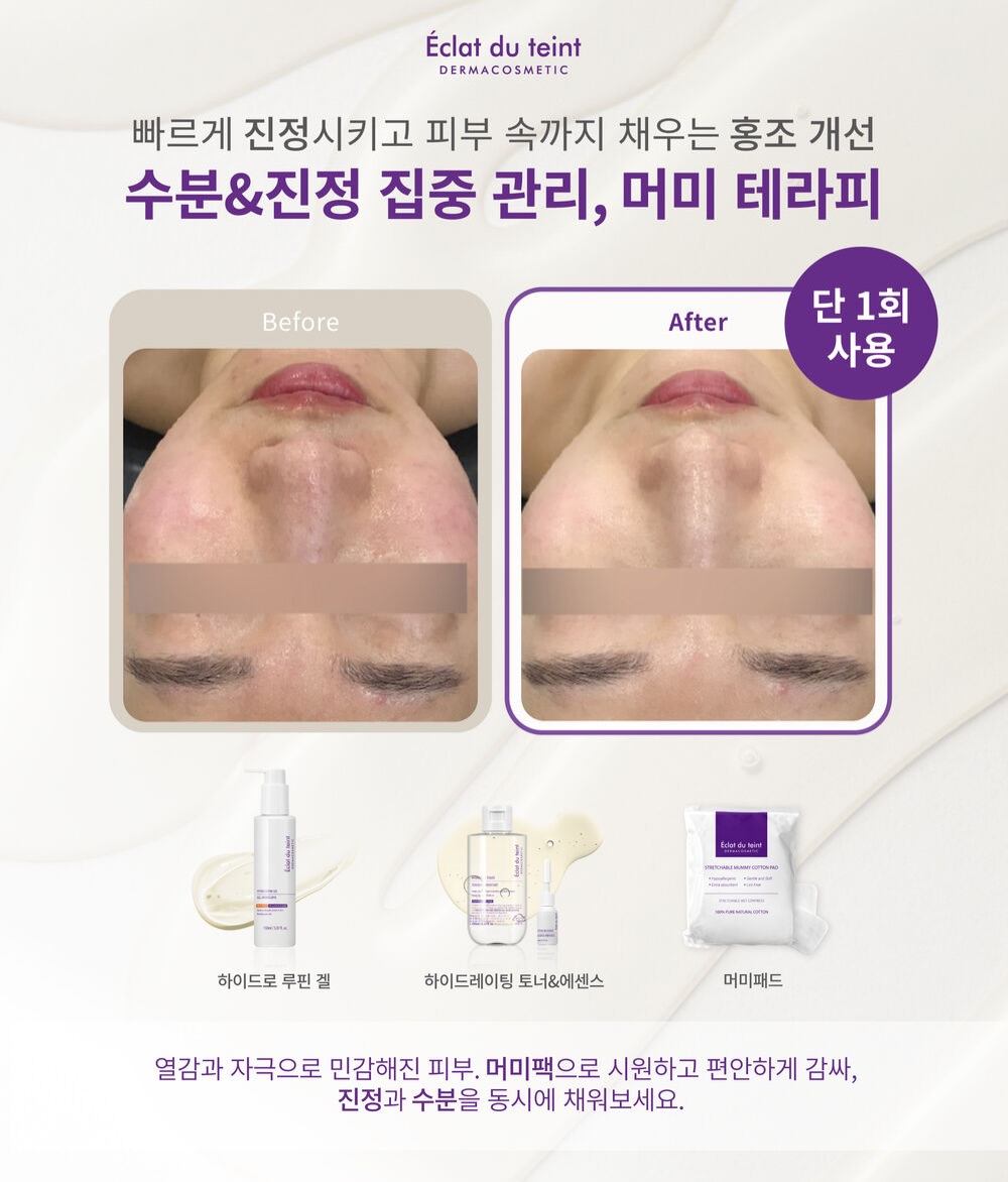 아크테릭스 반팔티 7