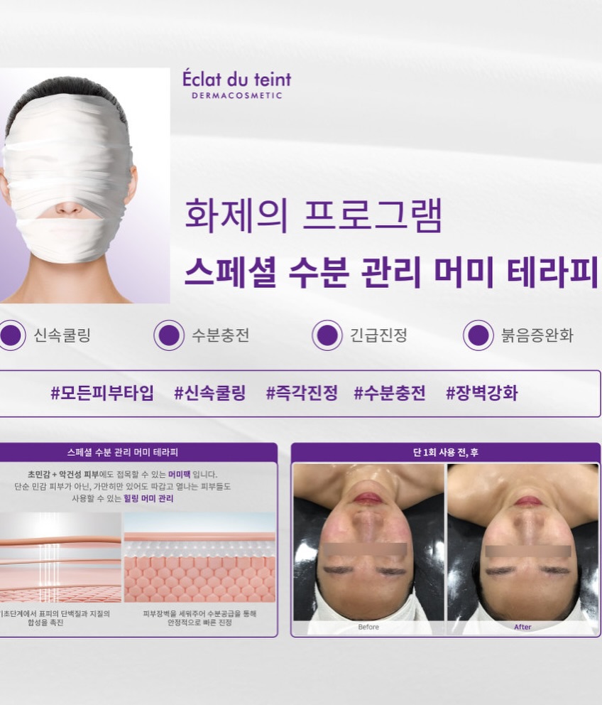 아크테릭스 반팔티 8