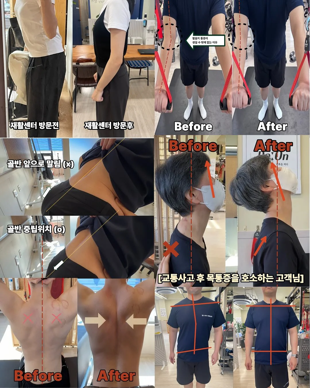 채니수트 5