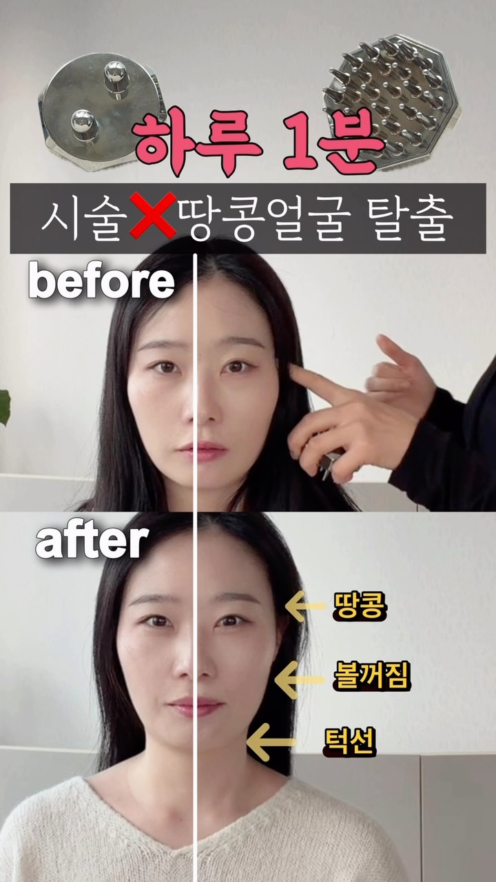 마운자로 영양제