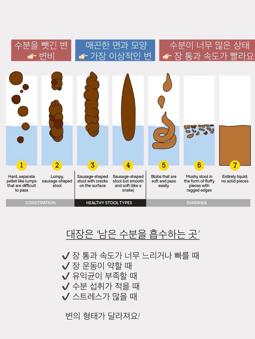 브이넥 탑 3