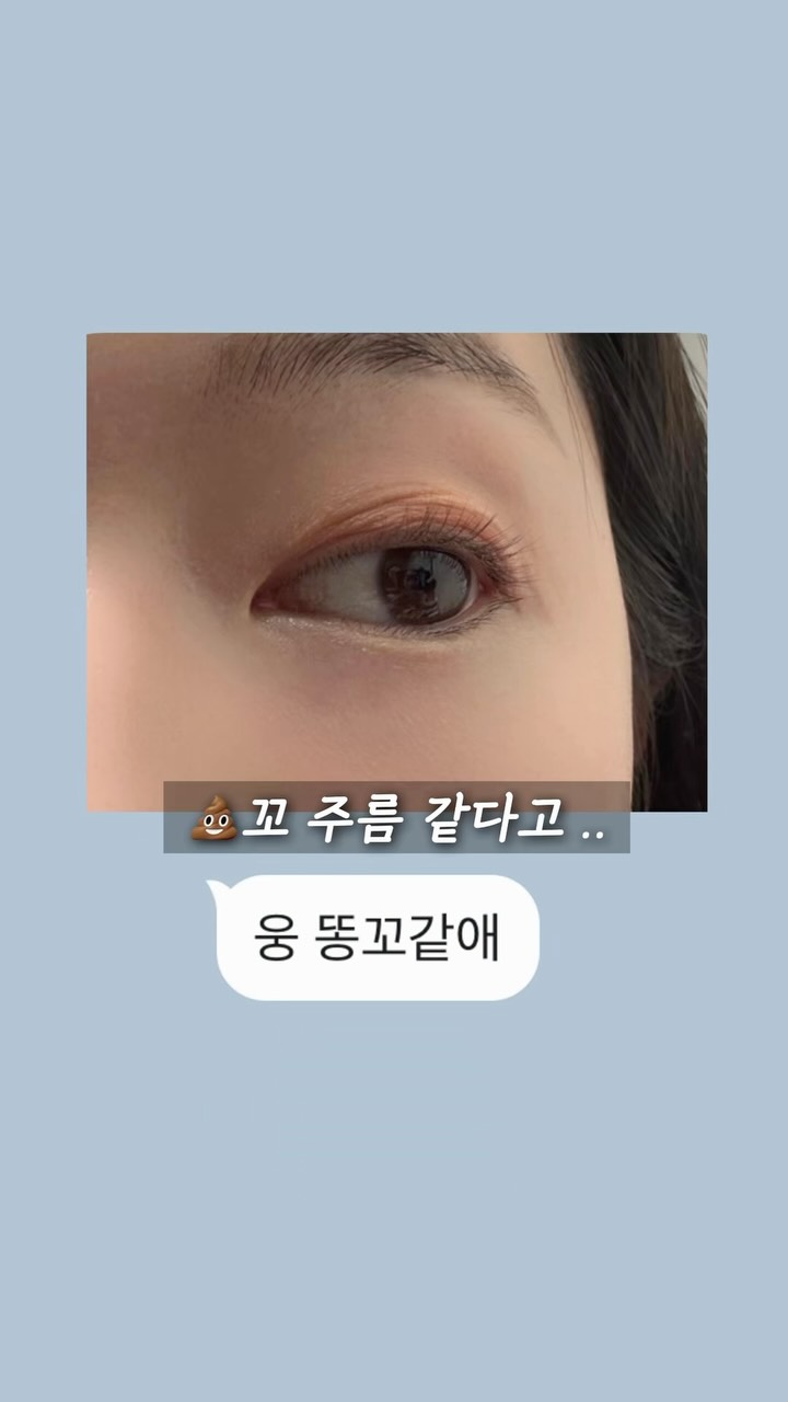 코재수술