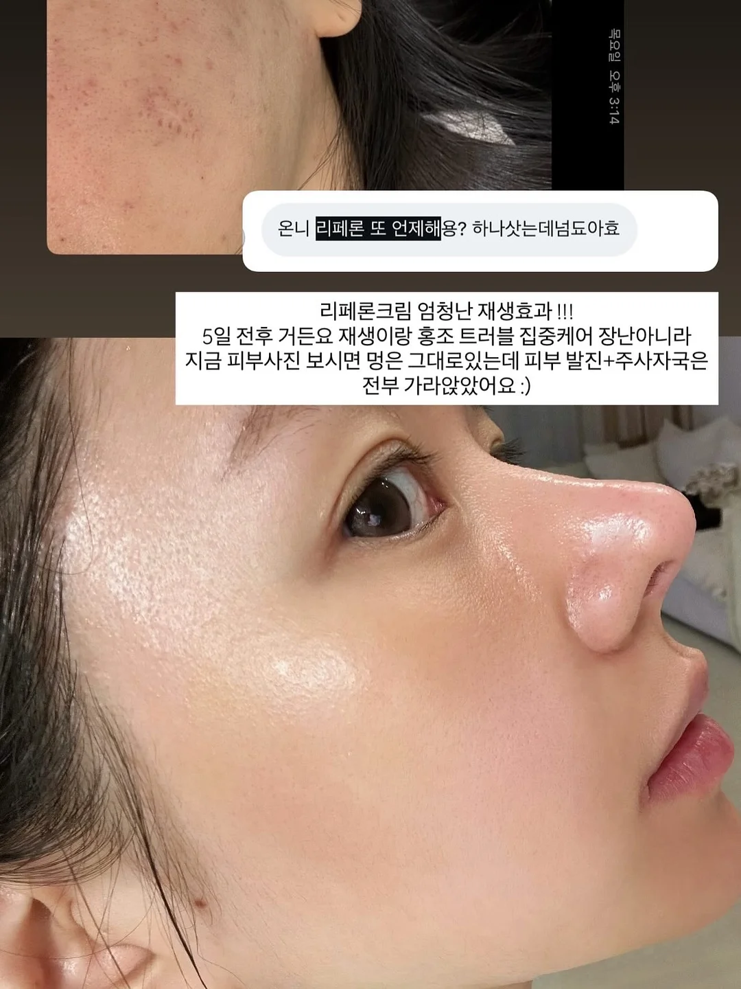 야옹티 1