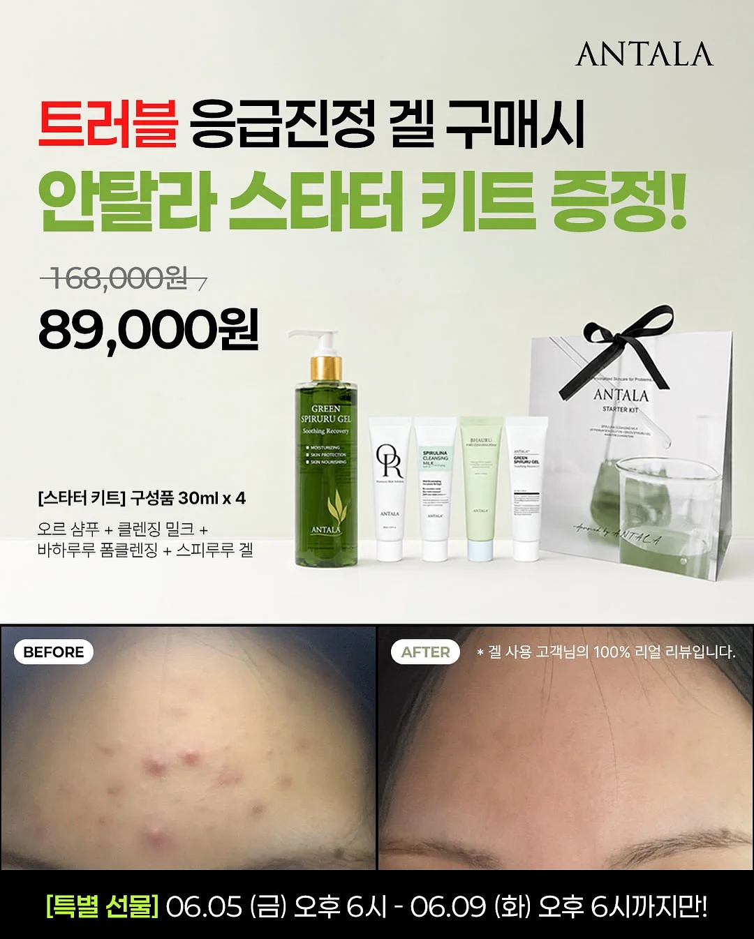 아더에러 반팔티 1