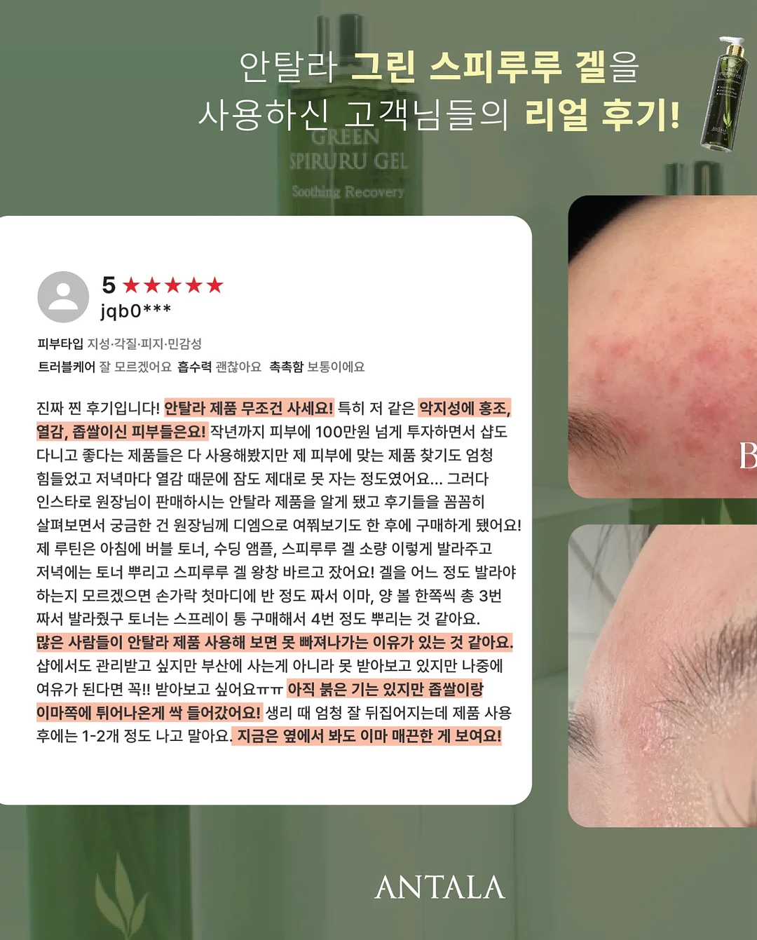 아더에러 반팔티 9