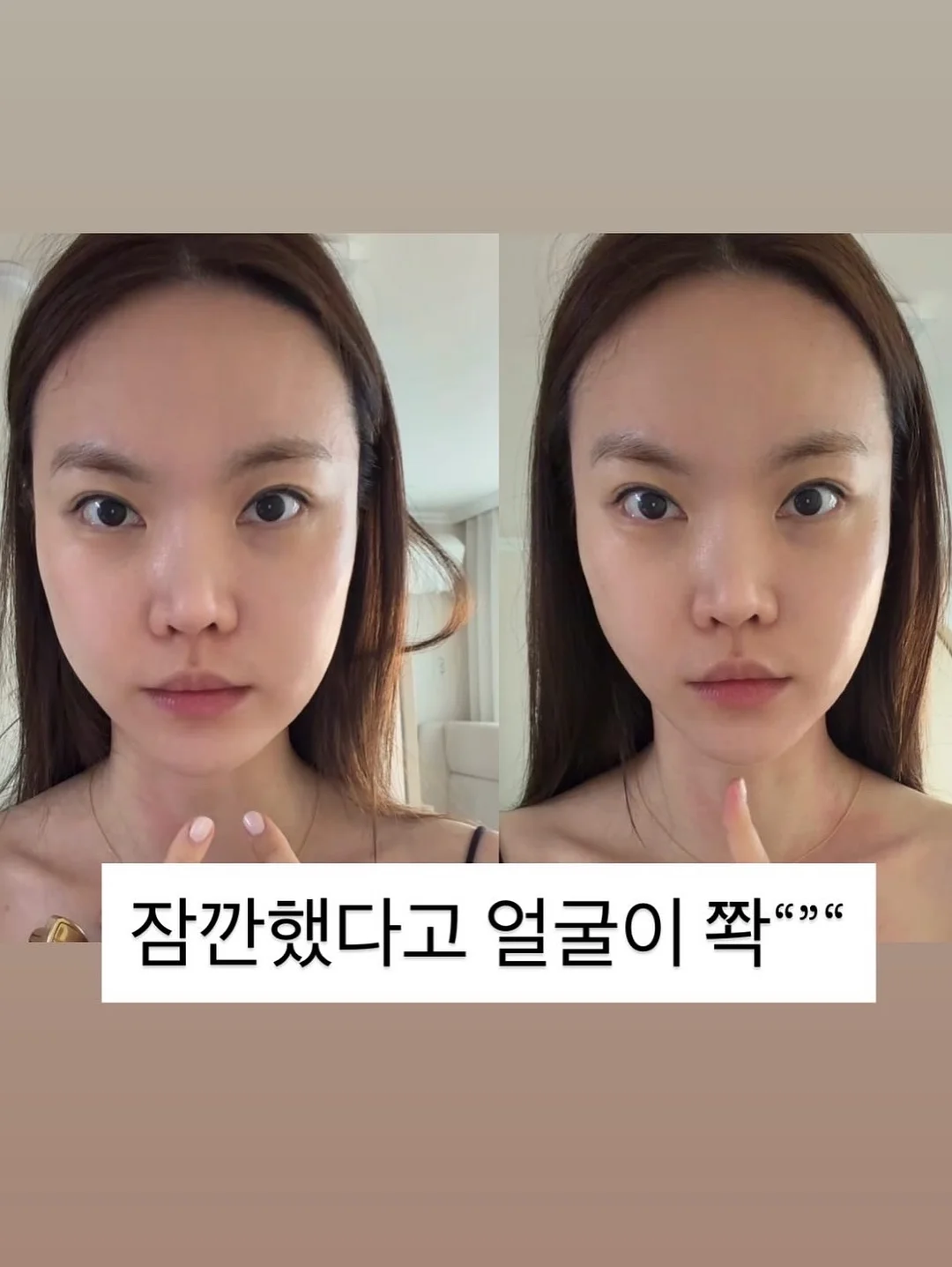 간호간병통합서비스 가이드 7