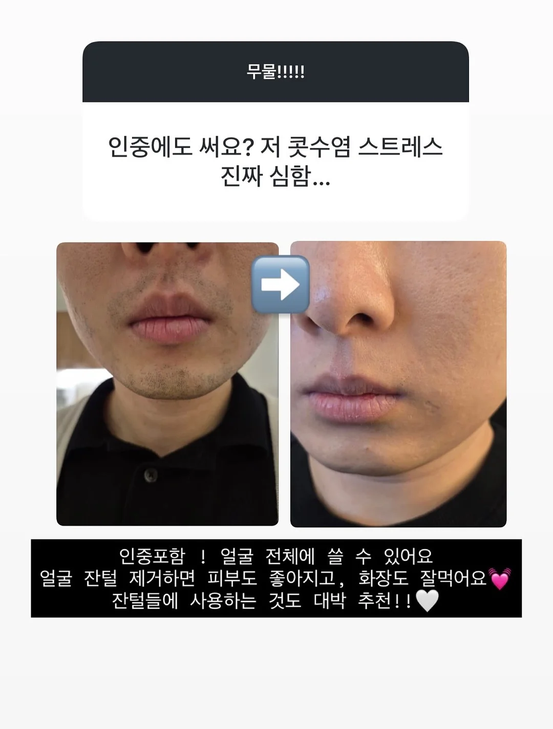 플리츠 쓰리피스 세트 8