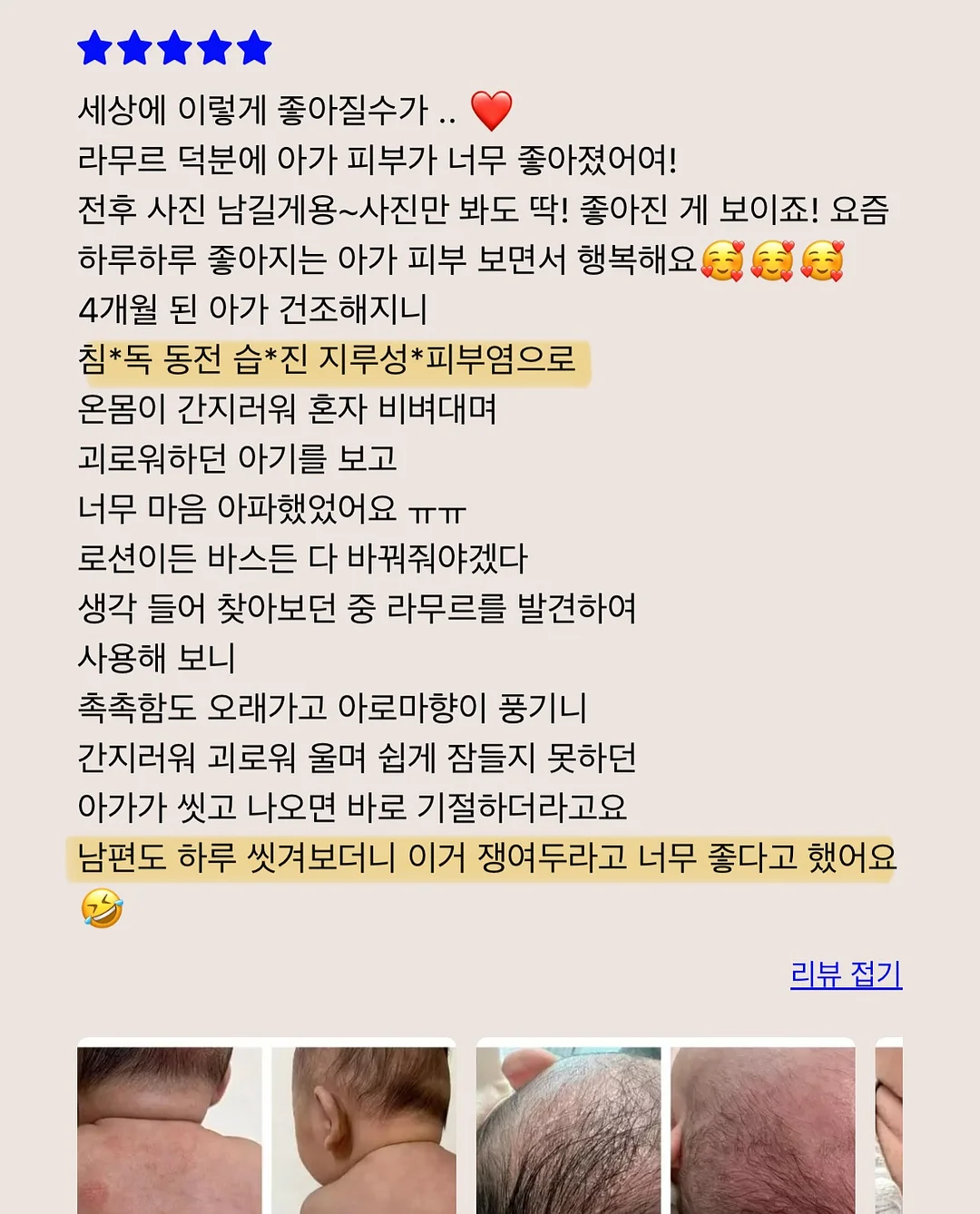 두피 스케일러, 가운, 인그로운 스크럽, 착색 토너, 등드름 미스트 9