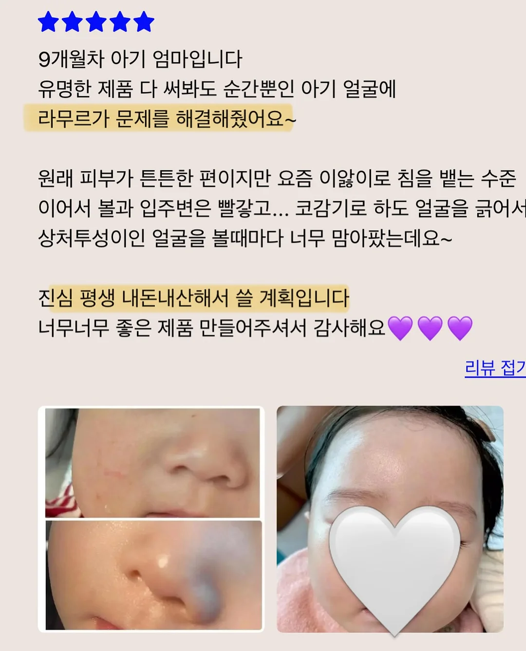 두피 스케일러, 가운, 인그로운 스크럽, 착색 토너, 등드름 미스트 10