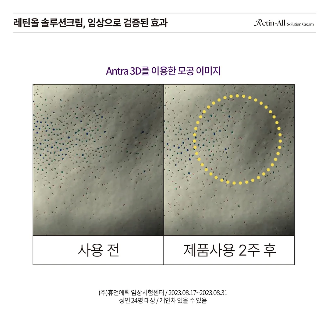 자수 디테일 스커트 11