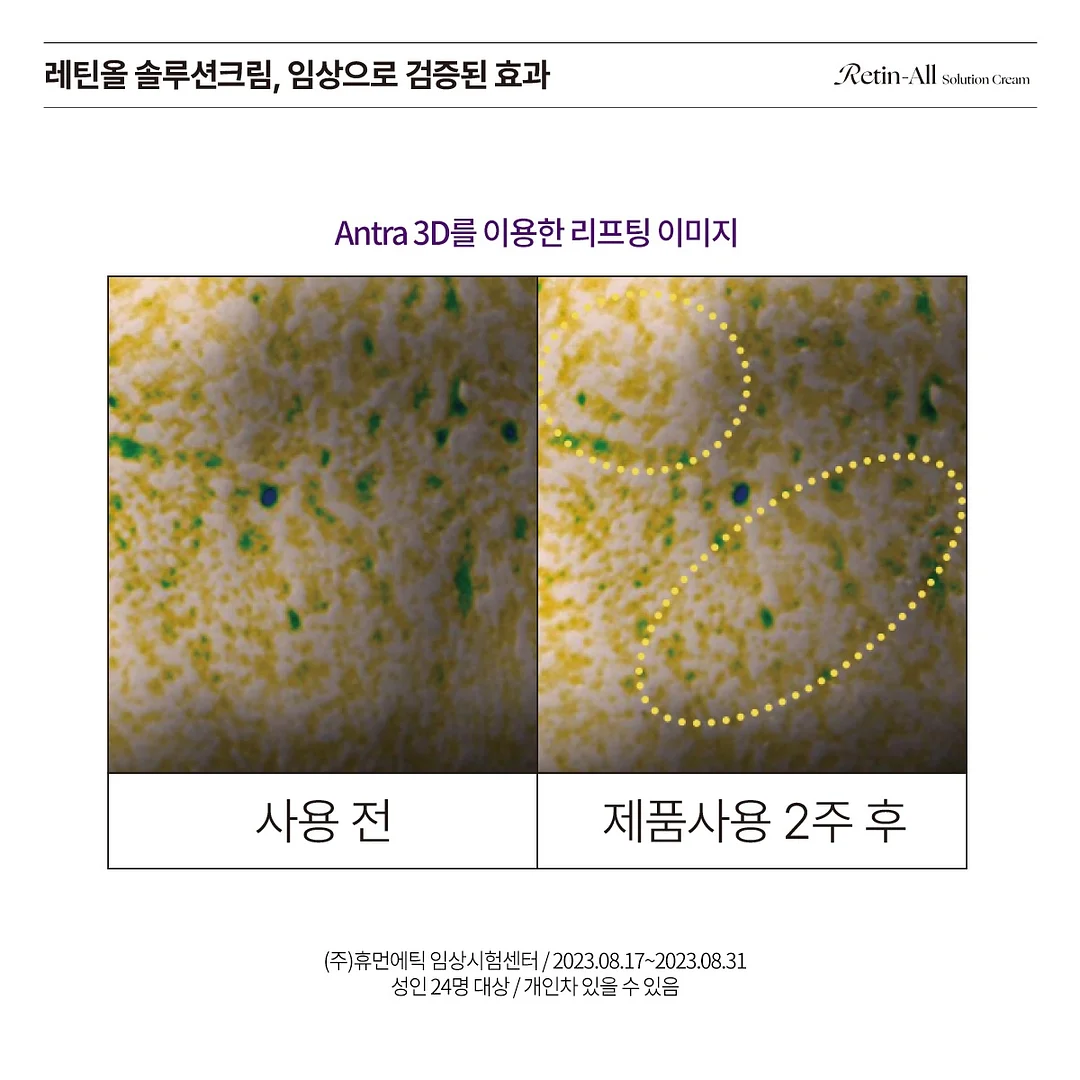 자수 디테일 스커트 13