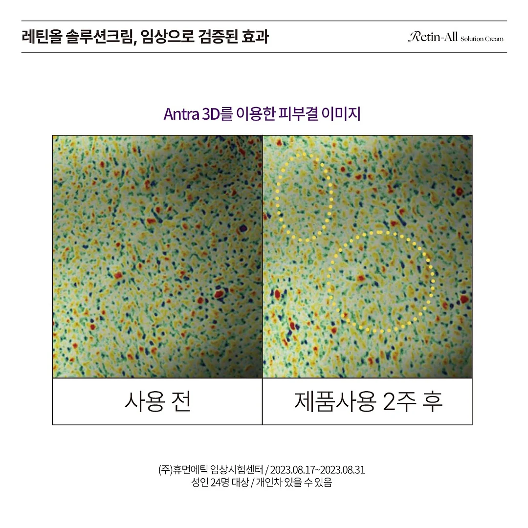 자수 디테일 스커트 15