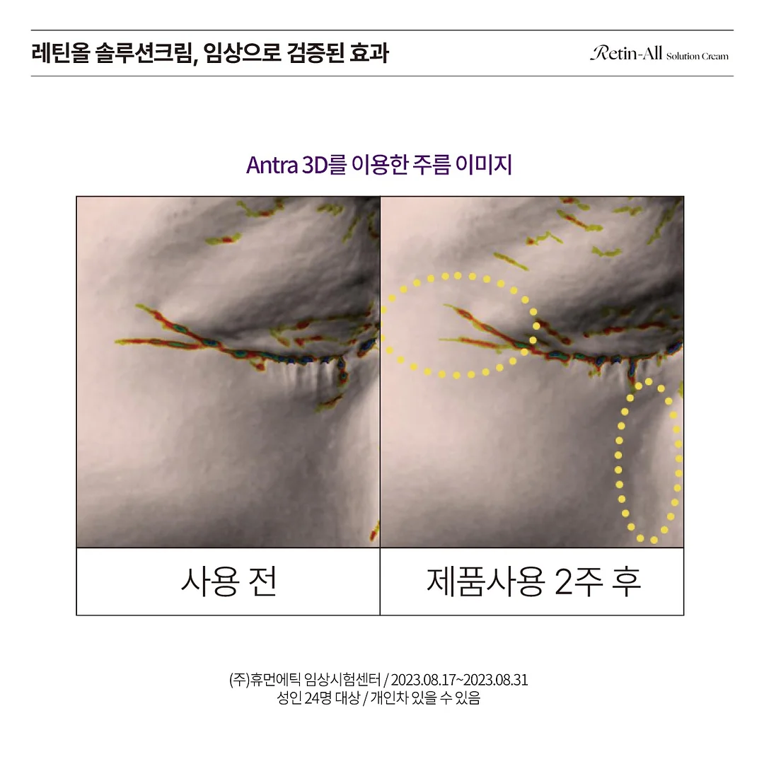 자수 디테일 스커트 9