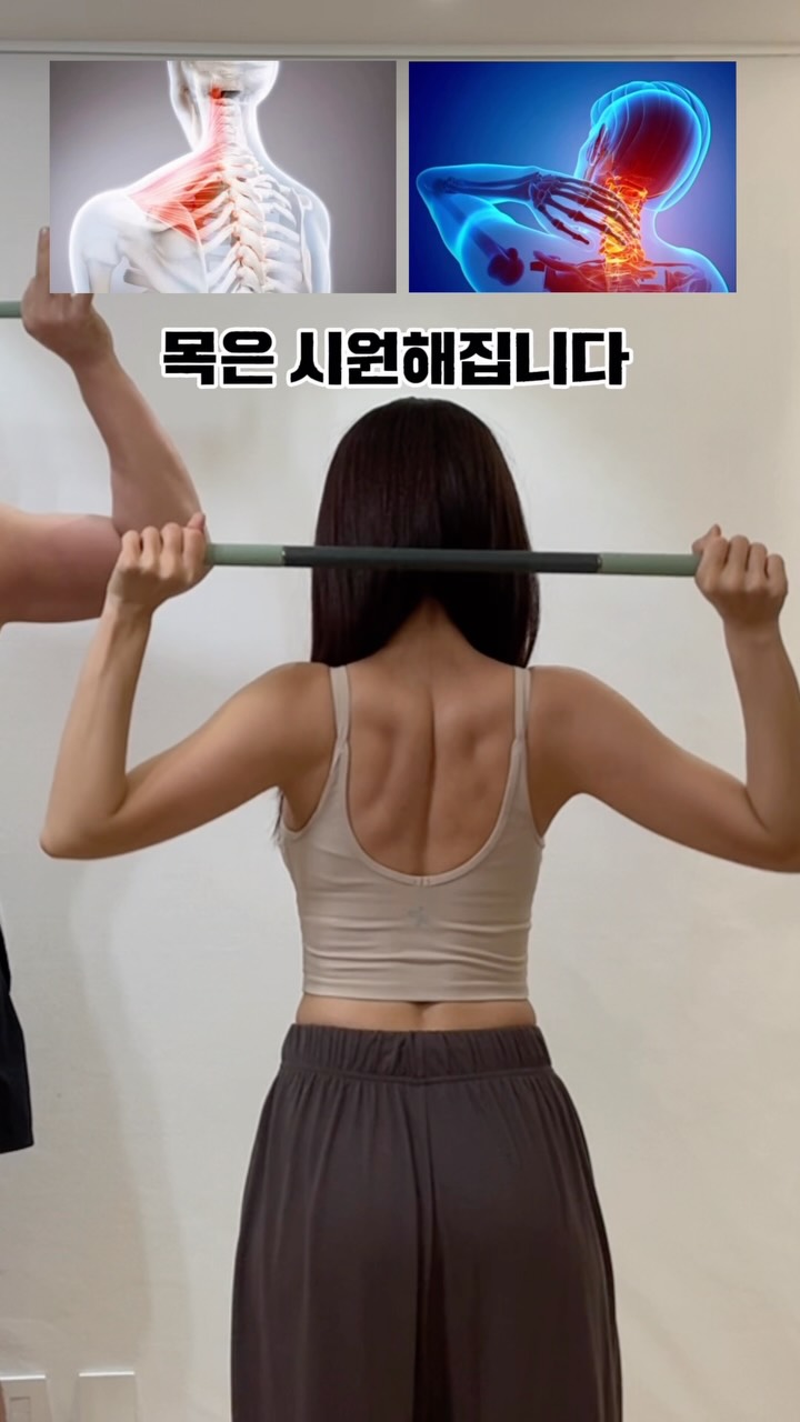 캐리어 바퀴 보호 제품