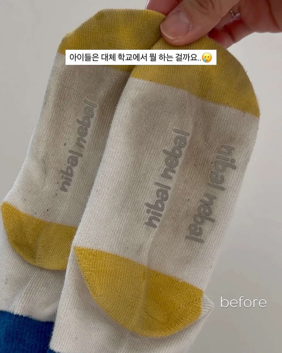화병 7
